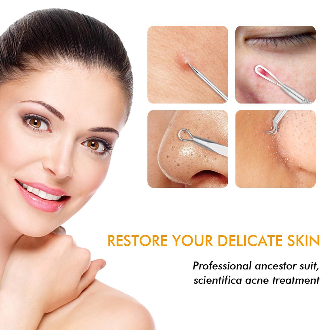 7-Piece Blackhead Remover Kit – Professional Stainless Steel Pimple Extractor Set